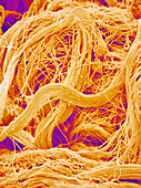 Skin collagen fibres,SEM