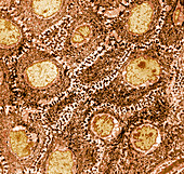 Skin cells,TEM