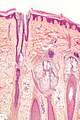 Human skin section,light micrograph