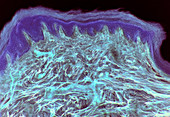 Skin layers,light micrograph