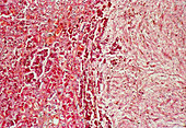 Light micrograph of human pituitary gland