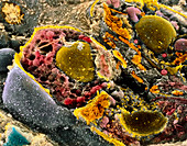 Coloured SEM of secretory cells in adrenal gland