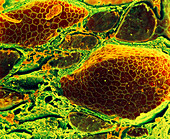 Coloured SEM of follicles in a human thyroid gland