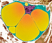 Fat cell,TEM