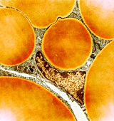 Fat cells,TEM