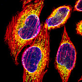 Fibroblast cells