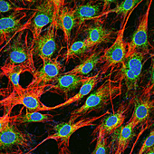 Fibroblast cells