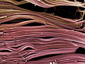 Collagen bundles,SEM