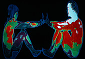 Thermogram of couple sitting,arms outstretched