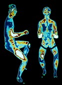 Thermogram of a man on an exercise bicycle