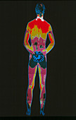 Thermogram of man