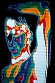 Thermogram of man holding left arm above head