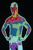 Thermograph of man with hands on his hips