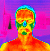 Thermogram of a man's head and shoulders
