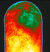 Thermogram of a human finger