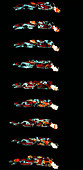 Sequence of 9 thermographs of sleeping man