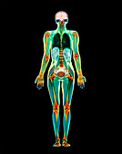 Coloured MRI scan of a whole human body (female)