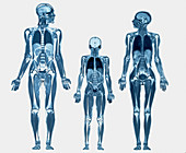 Whole body scans