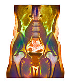 Abdominal scan,MRI