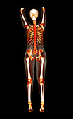 Female body,CT scan