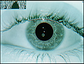 Computer screen image of an eye iris bein