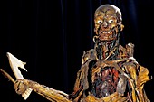 Human anatomy,Fragonard Museum