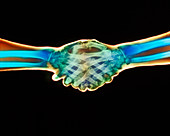 Coloured X-ray of a handshake