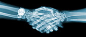 Handshake,X-ray