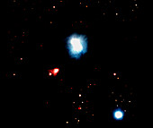 CCD optical image of R Coronae Australis nebula