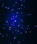 Core of star cluster M15,UV image