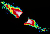 Infrared image of dust around star beta Pictoris