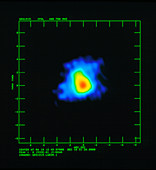 Microquasar at radio wavelengths