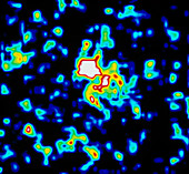 Gamma-ray burst supernova