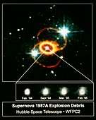 Hubble image of the supernova remnant SN 1987a