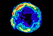 False-col radio image of Tycho's supernona remnant