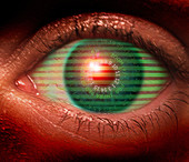Cybernetic eye