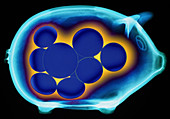 Coloured X-ray of a piggybank containing coins