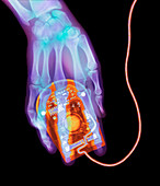 Coloured X-ray of a computer mouse and hu