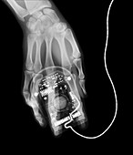 X-ray of a computer mouse and human hand