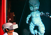 Researcher with 3D ultrasound image of foetus