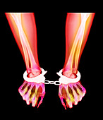 Coloured X-ray of a person's wrists in handcuffs