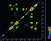 Pharmaceutical NMR display