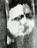 Early TV image