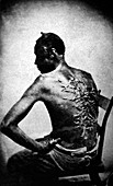 Whipped slave,USA,1863