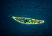 LM of Euglena acus,a protozoan algae