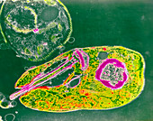 F/col TEM of Leishmania tropica