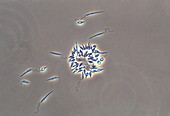 Leishmania protozoa