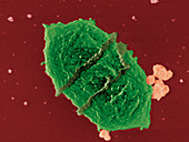 Giardia sp. protozoan,SEM
