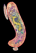 Parasitic protozoan,TEM