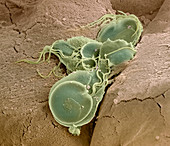 Giardia lamblia protozoa,SEM